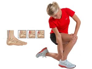 پارگی تاندون آشیل